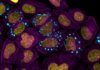 Protein Atlas Maps the Inner Workings of Cells