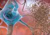 Sex-Specific Parental History of Alzheimer’s Could Identify At-Risk Adults