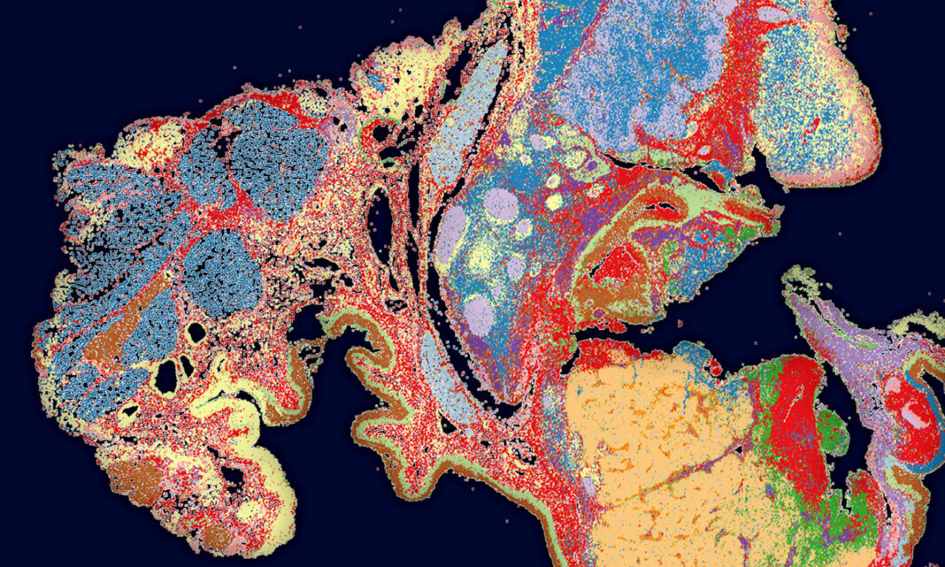 tumors