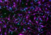Like LEGOs, bit.bio’s CNS Tool Kit Allows Brain Exploration Piece by Piece