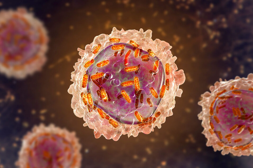 Leukaemia white blood cell with mitochondria, leukemia