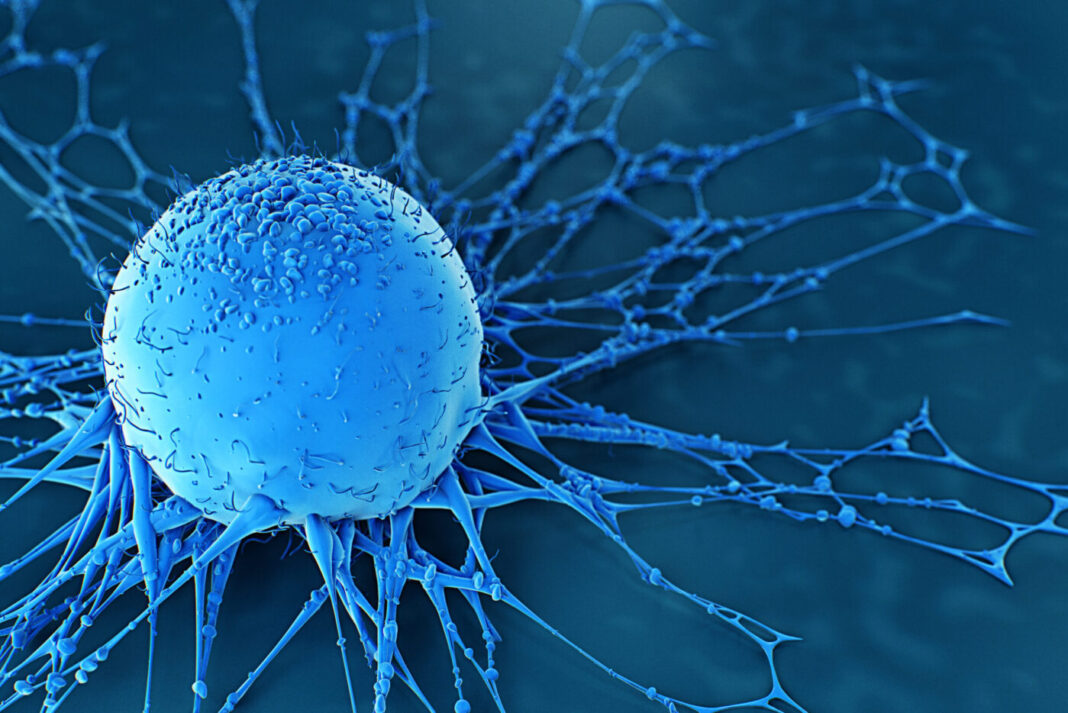 Image of human cancer cells