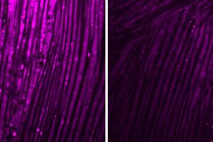 Research from Washington University School of Medicine in St. Louis reveals how brain inflammation triggers extreme muscle weakness across several diseases, including viral infection, bacterial infection and Alzheimer’s disease. Shown are fruit fly muscles; the violet staining is a measure of how well mitochondria in muscle cells are producing energy. On the left is a healthy muscle, and on the right is a muscle exposed to IL-6, an immune-related molecule produced by the brain in response to infections or chronic disease. [SHUO YANG]