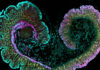 Spatial Biology Colors Outside the Lines